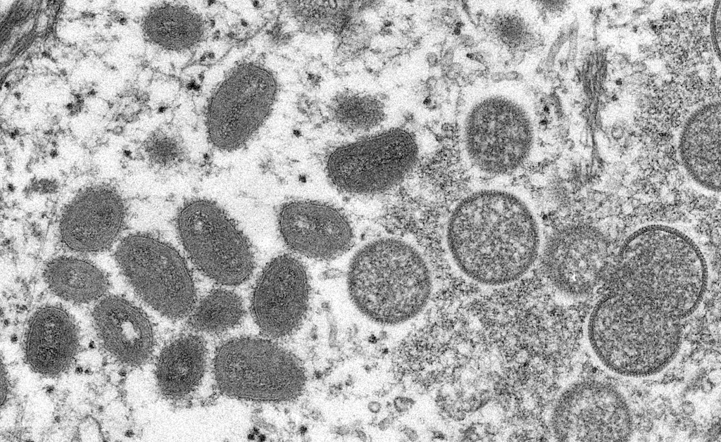 Mpox virus